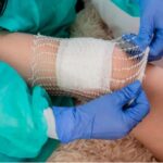 Chronic_wounds