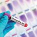 $2 Million Gene Therapy Might Become The Standard In The US