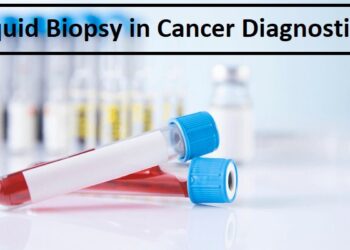 Liquid Biopsy in Cancer Diagnostics: Definition and Advantages