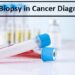 Liquid Biopsy in Cancer Diagnostics: Definition and Advantages