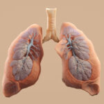 FDA-Approves-Brinsupri-by-Insmed-for-Chronic-Lung-Condition