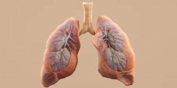 FDA Approves Brinsupri by Insmed for Chronic Lung Condition