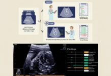 AI-Assisted Fetal Screening Sets New Standard at Mount Sinai AI assisted fetal screening