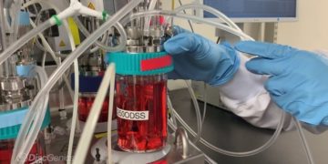 DiscGenics Cell Therapy for Disc Degeneration