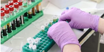 Incyte Announces First Patient Treated in Phase 3 Clinical Trial Program Evaluating Ruxolitinib Cream in Patients with Vitiligo