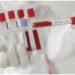 Phesi data show clinical trial suspensions continue to rise as COVID-19 impact on development persists