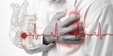 FDA Approves Ticagrelor to Reduce Risk of First Heart Attack, Stroke in Patients with Coronary Artery Disease