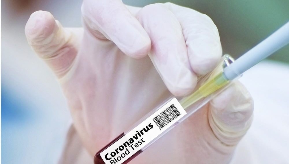 Sun Pharma receives approval from DCGI to initiate clinical trial with Nafamostat in Covid-19 patients