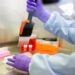 Sygnature expands capabilities with acquisition of Alderley Oncology