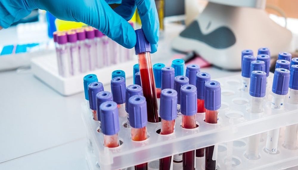 Zenith Epigenetics and Newsoara Biopharma Licensing Agreement for ZEN-3694