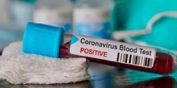GAC Beneficiary Houston Methodist Investigates Immunotherapy Techniques to Curb COVID-19