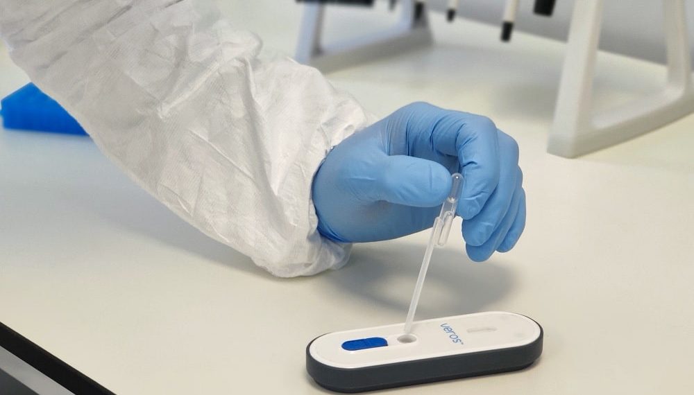 Sense Accelerates Instrument-Free Molecular Diagnostic Test for COVID-19
