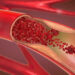 Blood Vessel Route- Major Discovery In Alzheimers Treatment