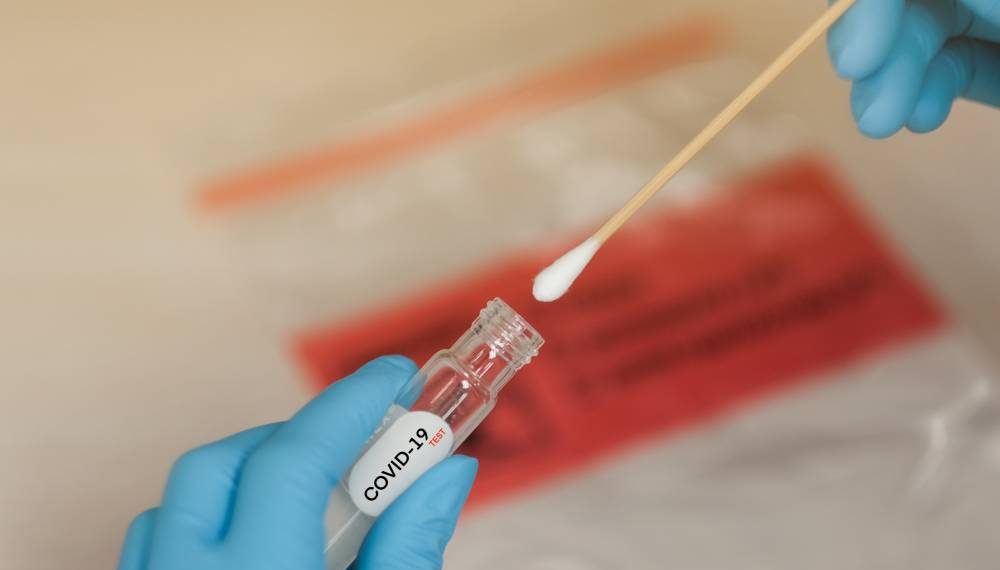 CENTOGENE Releases a New Swab Product to Facilitate the Simple Diagnosis of COVID-19