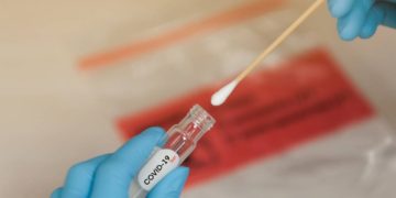 CENTOGENE Releases a New Swab Product to Facilitate the Simple Diagnosis of COVID-19