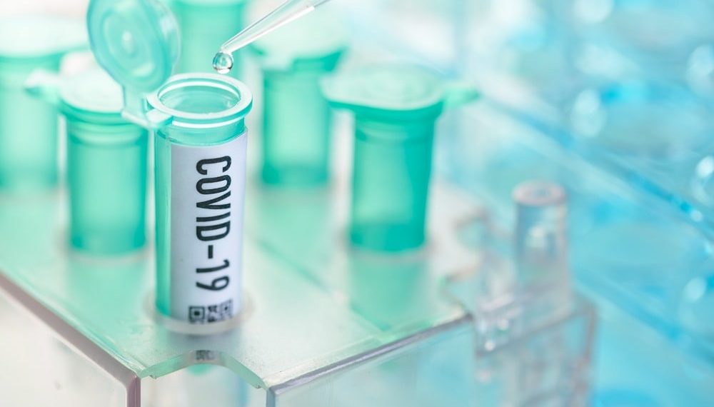 AdaptVac teams up with AGC Biologics to develop and produce COVID-19 vaccine