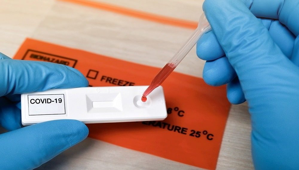 Abbott Earns Emergency Use Authorization for Another COVID-19 Antibody Test