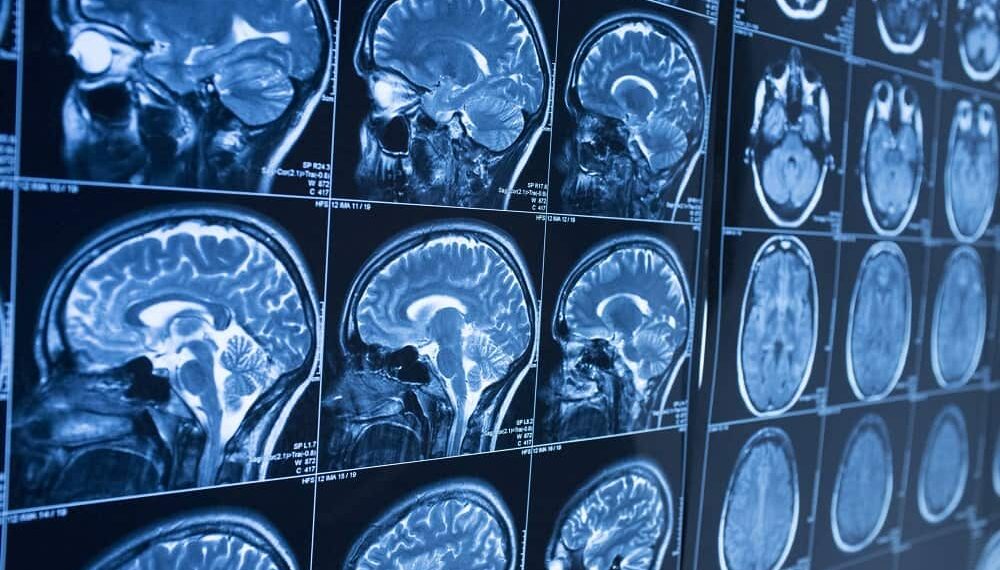 Cell-Energy Activity In Organs, Tissues By New MRI Method